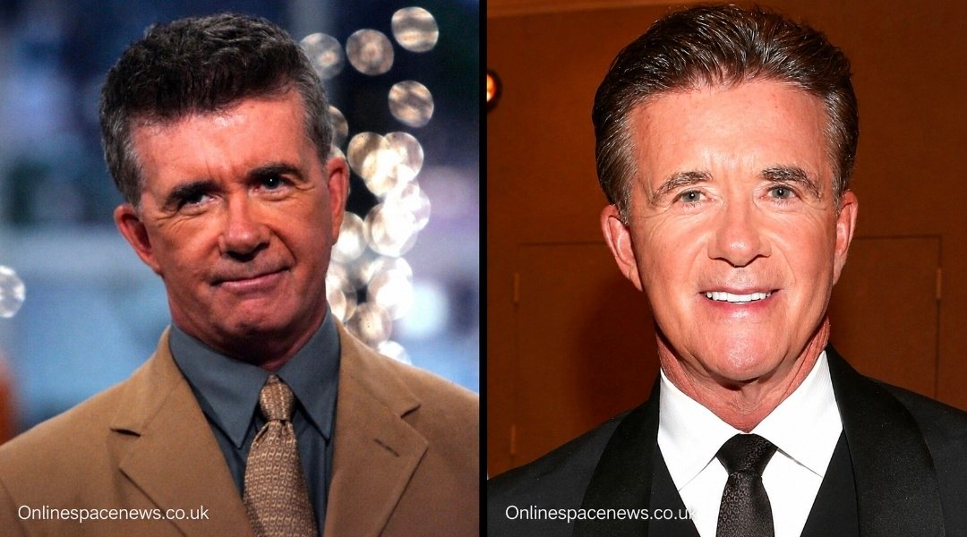 Who Is burt thicke? The Remarkable Life of Alan Thicke